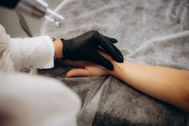Can Laser Tattoo Removal  Erase Amateur Tattoos