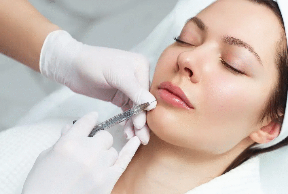 Lip Augmentation with Fillers Injection
