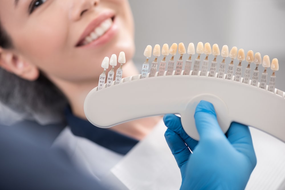 Common Myths About Dental Veneers Debunked
