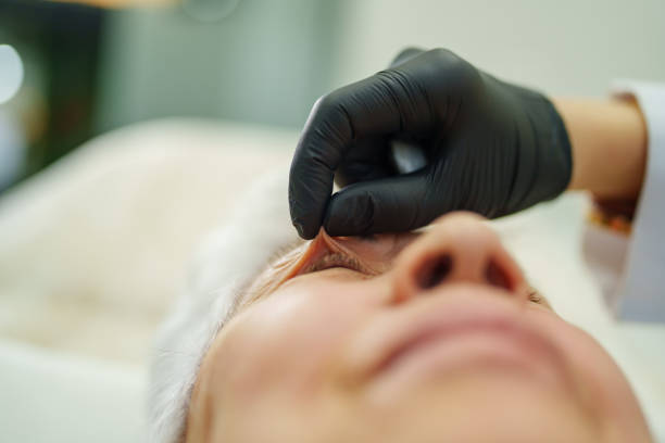 Does Eyelid Surgery Leave Noticeable Scars