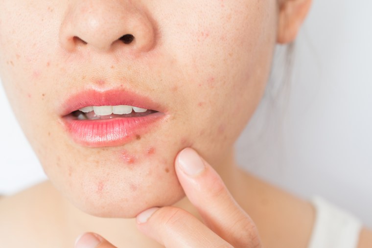 Does Skin Diseases Treatment Suit All Skin Types