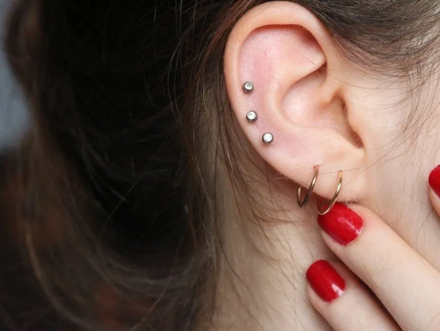 Earlobe Surgery Before and After Real Results, Real Confidence