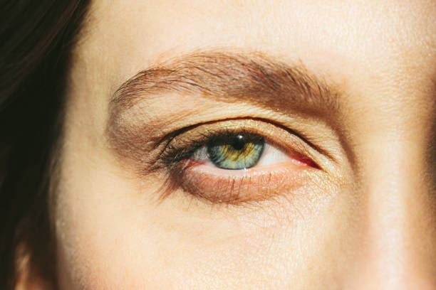 Eyelid Surgery in Riyadh