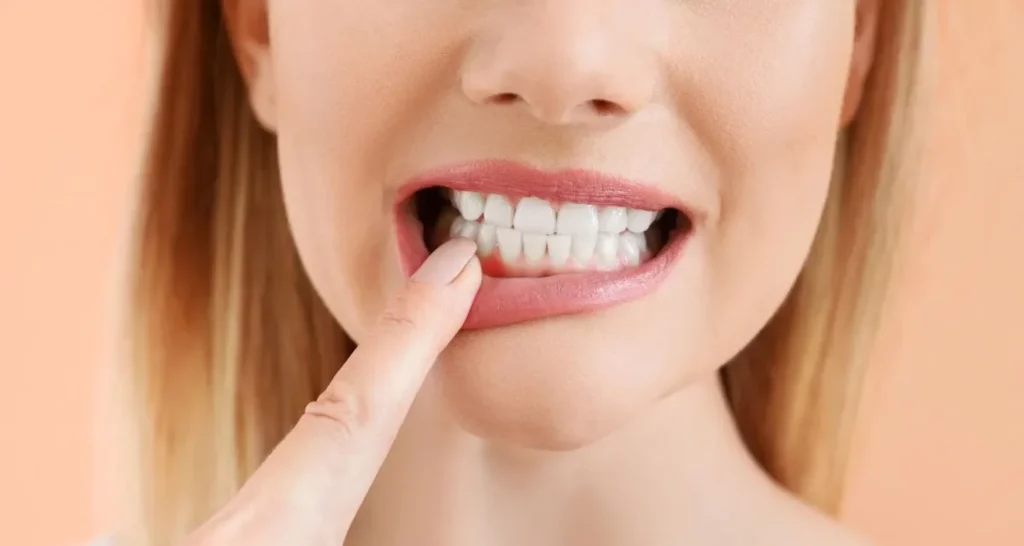 Gum Contouring for Uneven Gums Effective Solutions