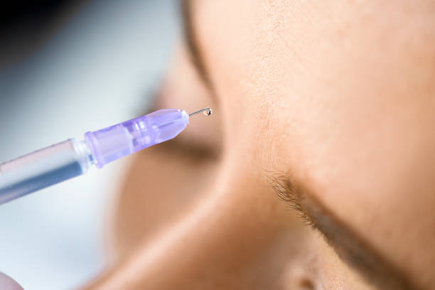 How Long Do Wrinkle Smoothing Injections Last
