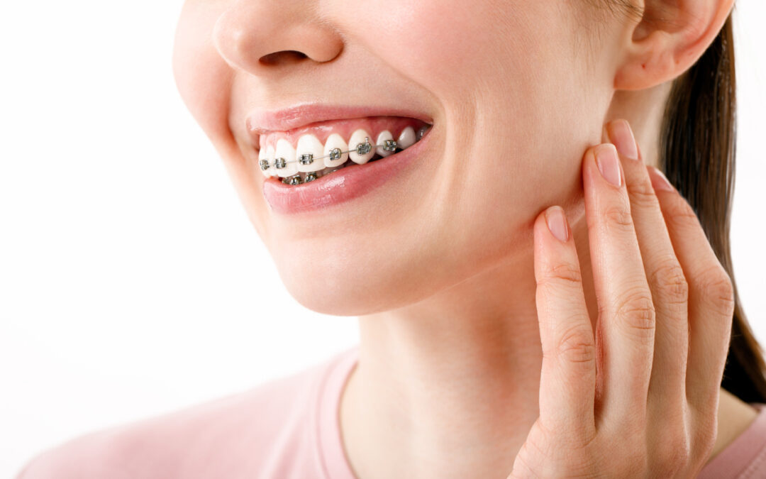 How Long Does Dental Braces Treatment Take? Factors That Affect Duration