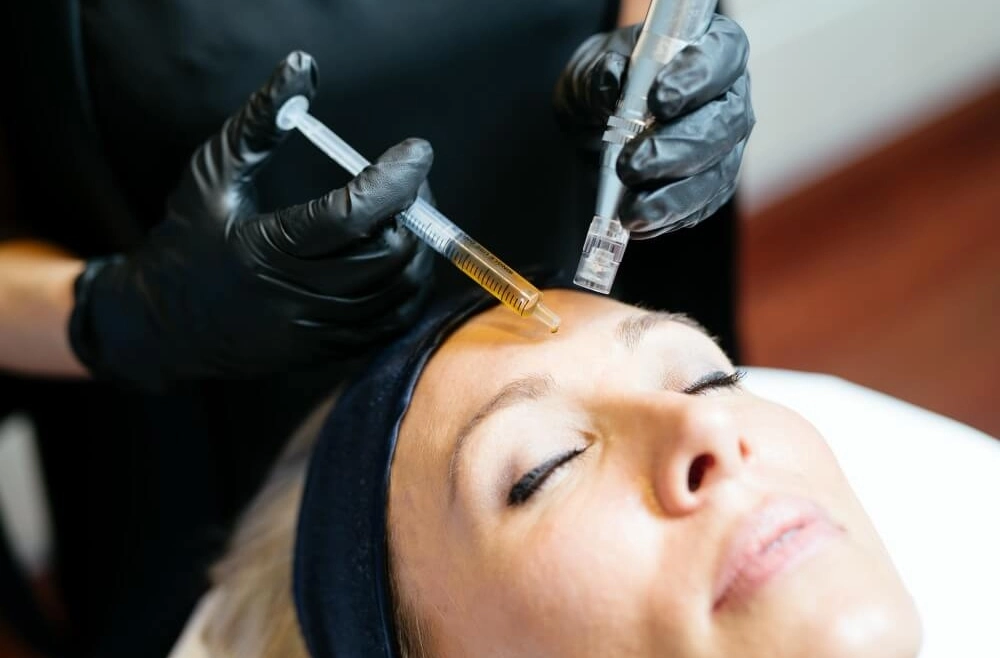 How Mesotherapy Treatment Revives Dull Skin Quickly