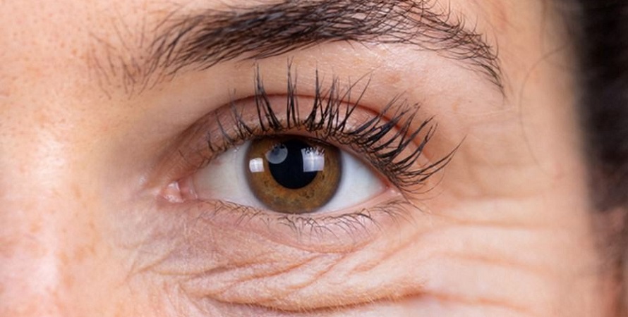 Is Eyelid Surgery Worth It Real Results and Expert Insights