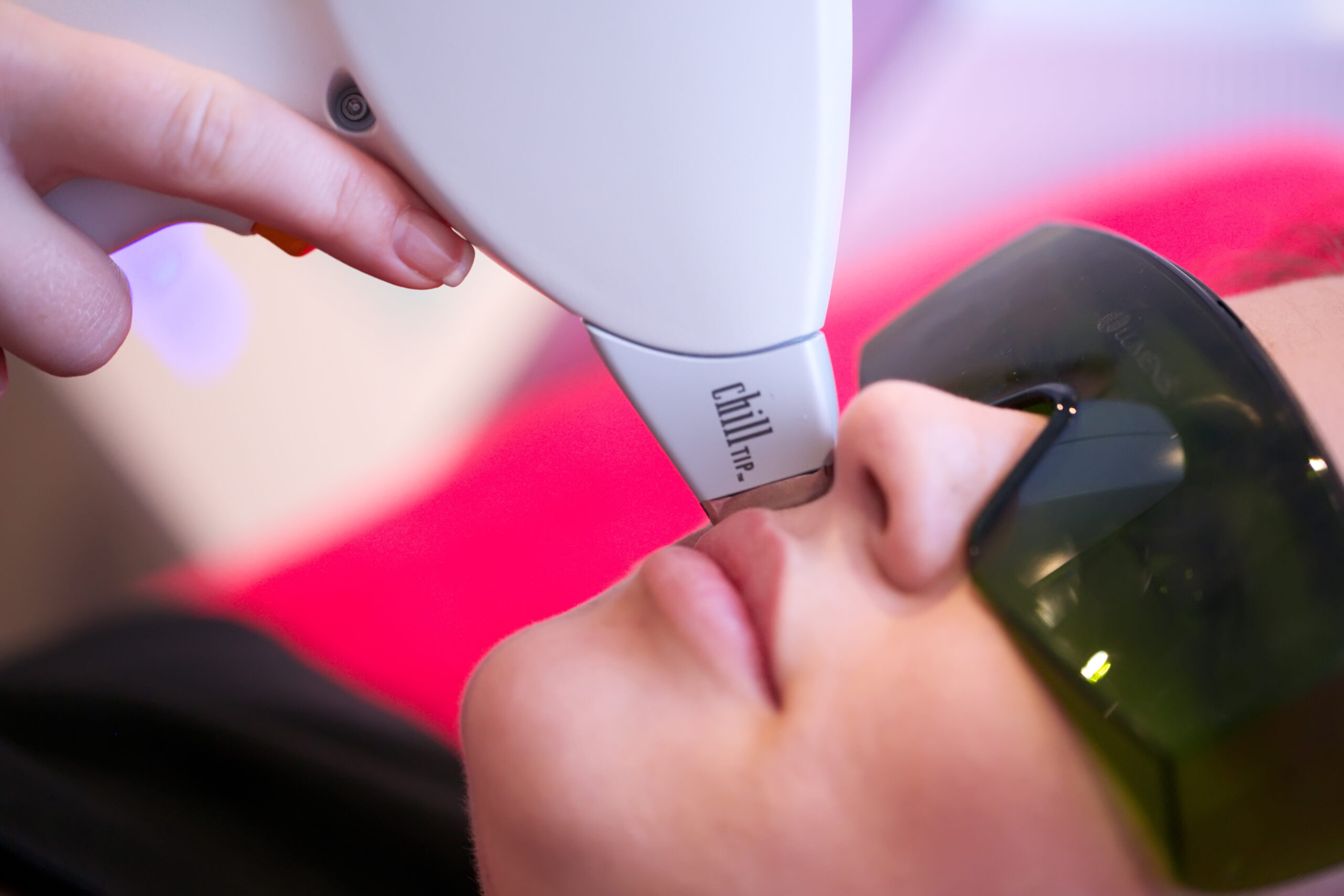 Is Laser Hair Removal Safe A Guide to Risks, Results, and Recovery