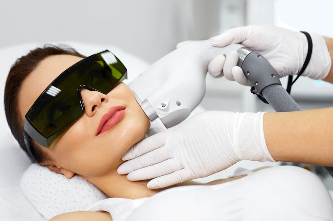 Laser Hair Removal for Sensitive SkinSafe, Effective, and Painless