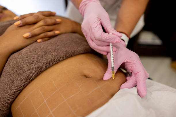 Laser Liposuction in Riyadh