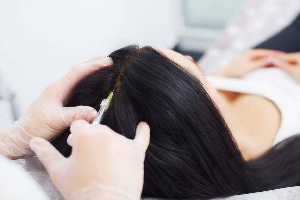 Exploring the Mechanism of PRP Hair Treatment on Damaged Hair