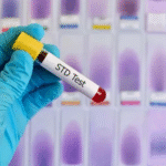 STD Test in Dubai