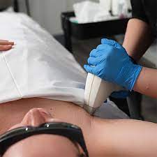 Chest and Back Laser Hair Removal Price List