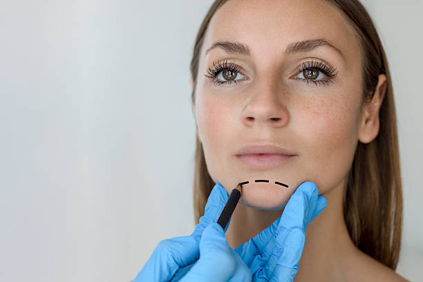 Timeless Beauty with Facelift Surgery