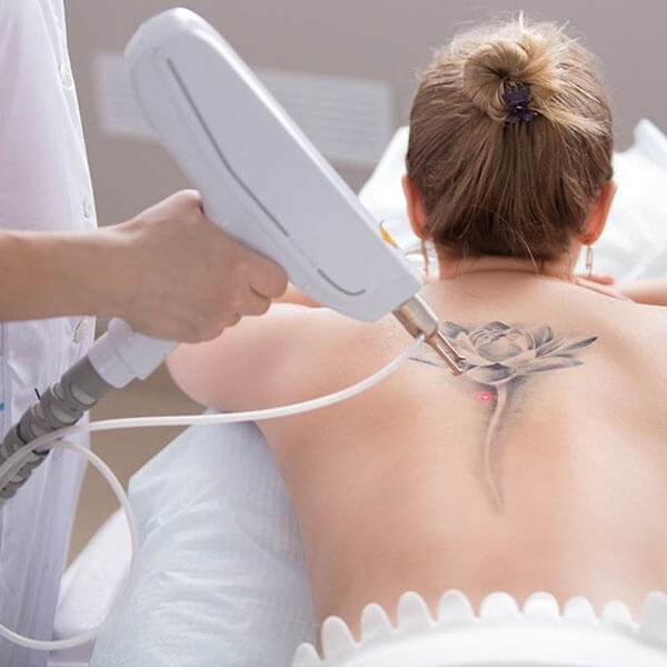 Transform Your SkinThe Top Reasons to Choose Laser Scar Removal