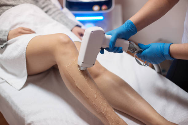 What Is Laser Hair Removal and How Does It Work