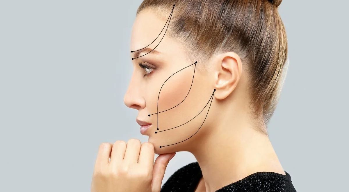 What Recovery Time Does EndoLift Need