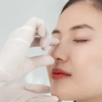 Rhinoplasty Surgery in Dubai