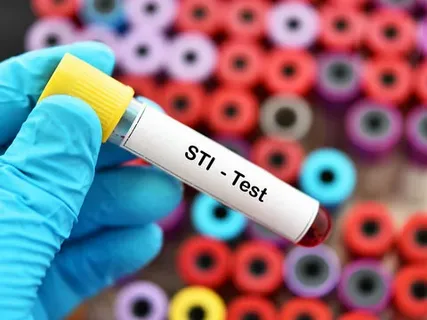 Protect Your Future: Why an STD Test in Dubai is Essential for Every Adult