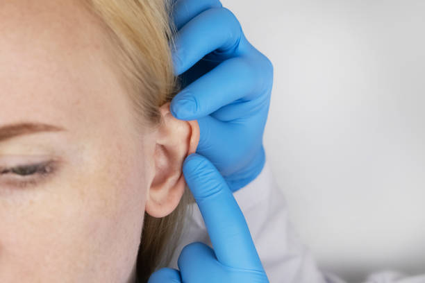 اتجه لجراحة تجميل الأذن في الرياض لتحصل على الثقة الكاملة
