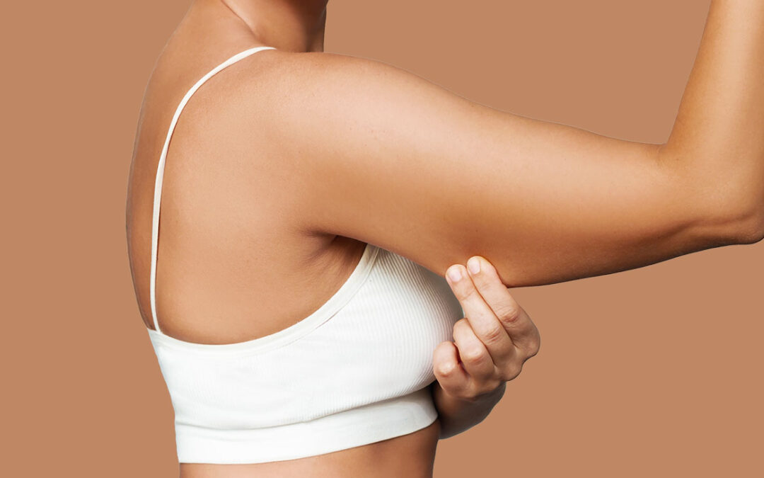 How Much Skin Is Removed During an Arm Lift?