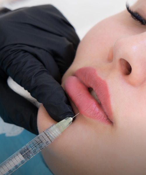 Do Russian Lip Fillers Change Lip Texture?