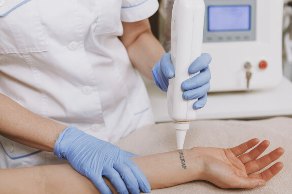 Boost Your Job Prospects with Laser Tattoo Removal