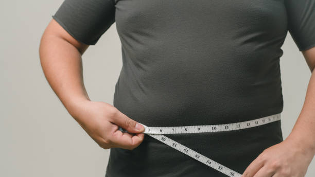 Can Gastric Sleeve Surgery Help With Sleep Apnea