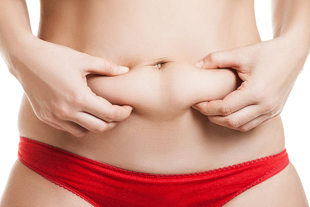 Can Mini Abdominoplasty Help Reduce Skin Laxity