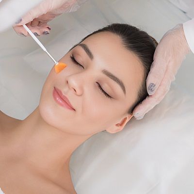 Chemical Peel in Dubai