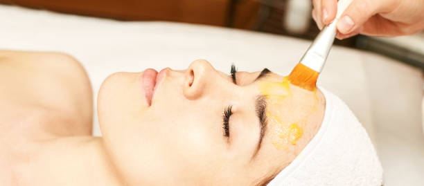Chemical Peels in Dubai for Radiant, Smooth Skin