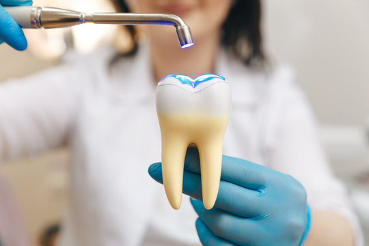 How to Spot a Failing Dental Tooth Filling Early
