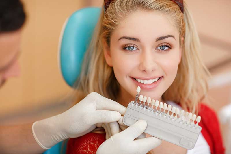 Affordable Alternatives to Veneers: What Are Your Options?