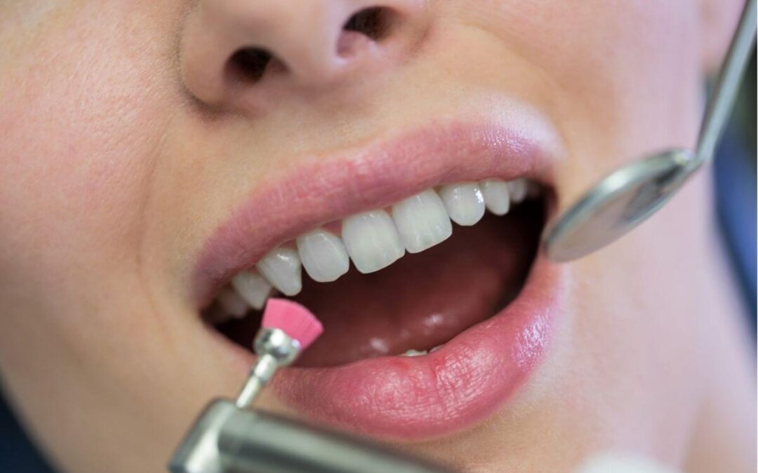 Teeth Scaling vs. Whitening: What’s the Difference?