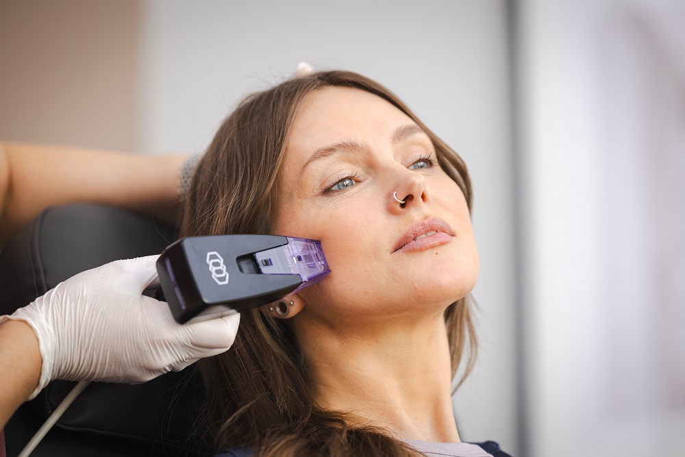 Does Morpheus 8 Treatment Help Acne Scars?