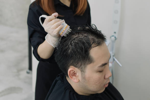 Exosomes Therapy for Hair Loss in Riyadh: Safe and Effective Treatment