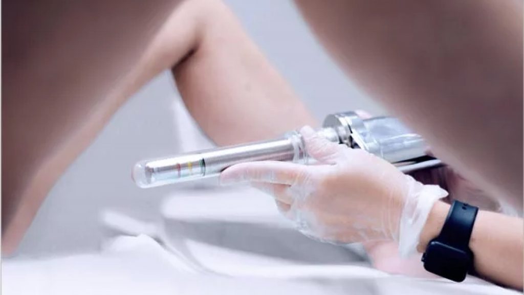 Can Laser Vaginal Tightening Treat Urinary Incontinence?