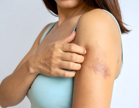 Expert Burn Reconstructive Surgery for Optimal Recovery