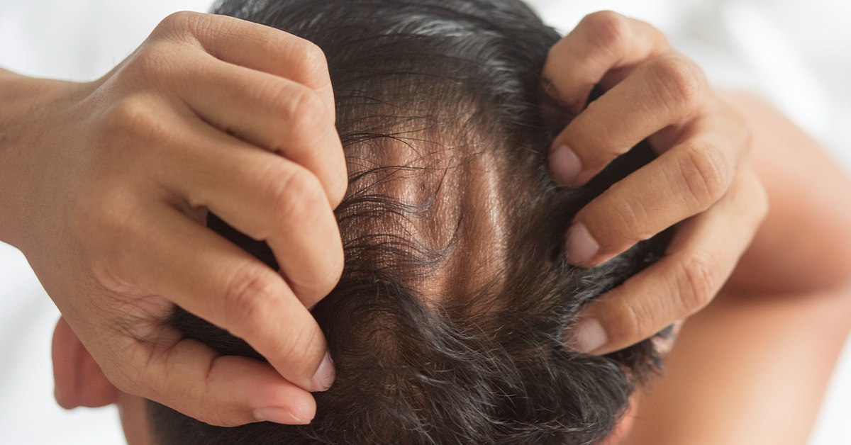 Future of hair restoration.