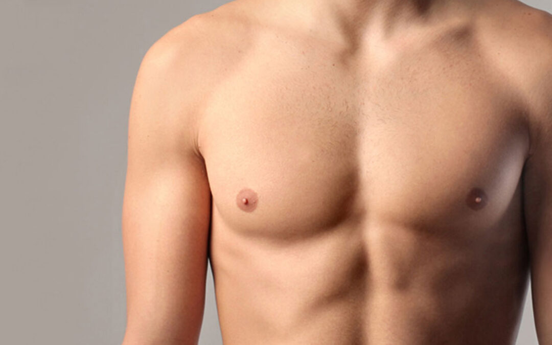 Expert Tips for Choosing Gynecomastia Surgery in Riyadh with Care
