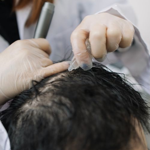 Hair Loss Solutions for All Ages