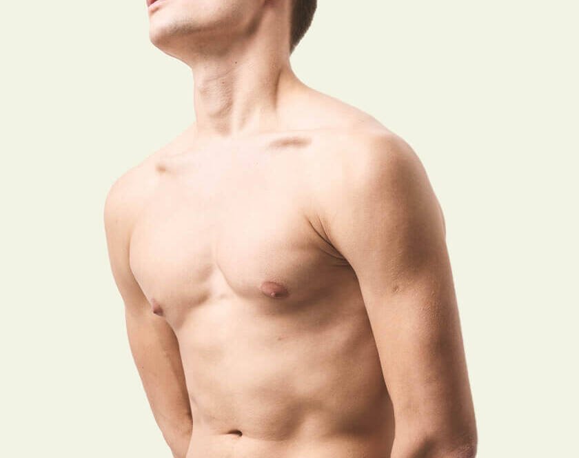 What’s Included in the Cost of Gynecomastia Surgery? A Full List