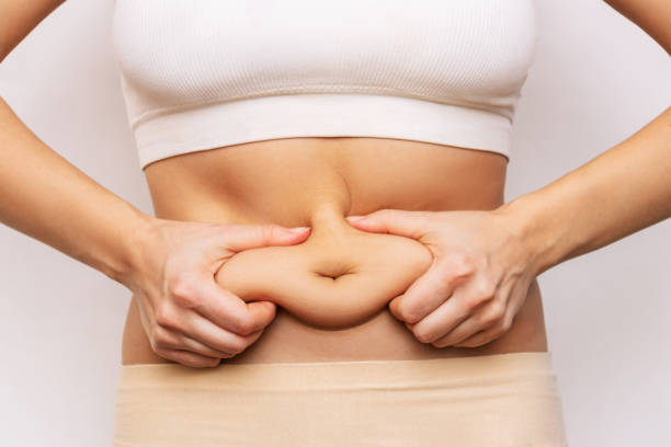 How Long Do Results from Laser CoolSculpting Last