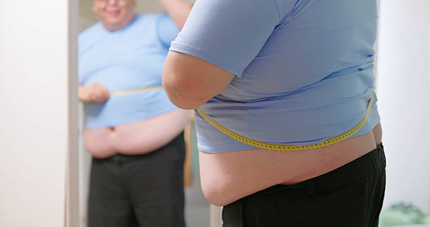 How Long Does Liposuction Surgery Recovery Take