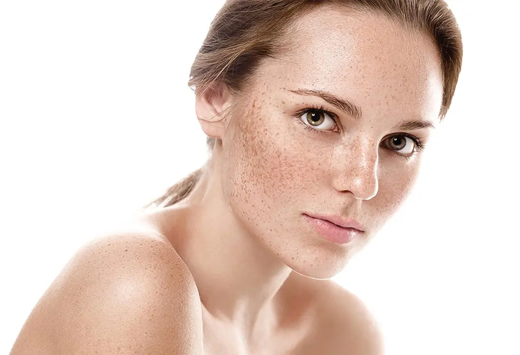 How Long Does Pigmentation Treatment Take to Work