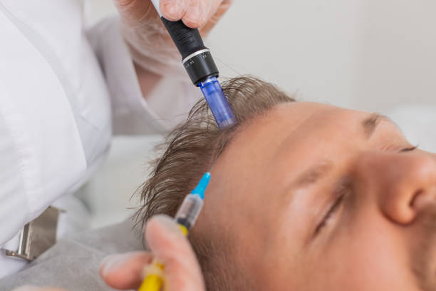 How Safe Are Hair Fillers for Sensitive Scalps