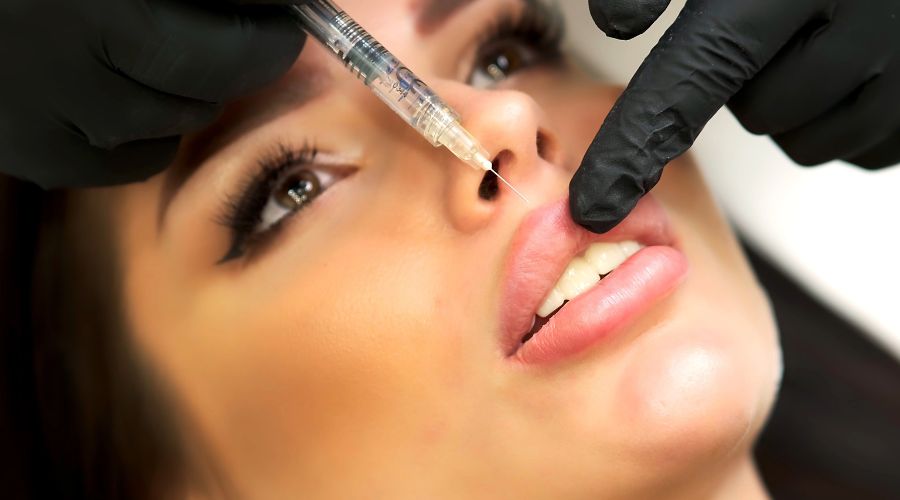 How Soon Can You See Lip Filler Results
