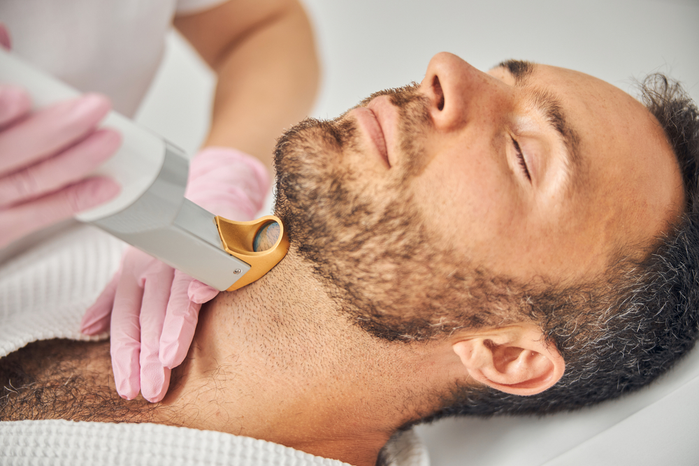 Is Beard Laser Hair Removal Permanent or Temporary