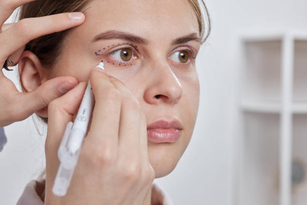 Is Eyelid Surgery the Right Choice for You